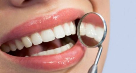Carie e parodontite i principali disturbi del cavo orale per l'oms.