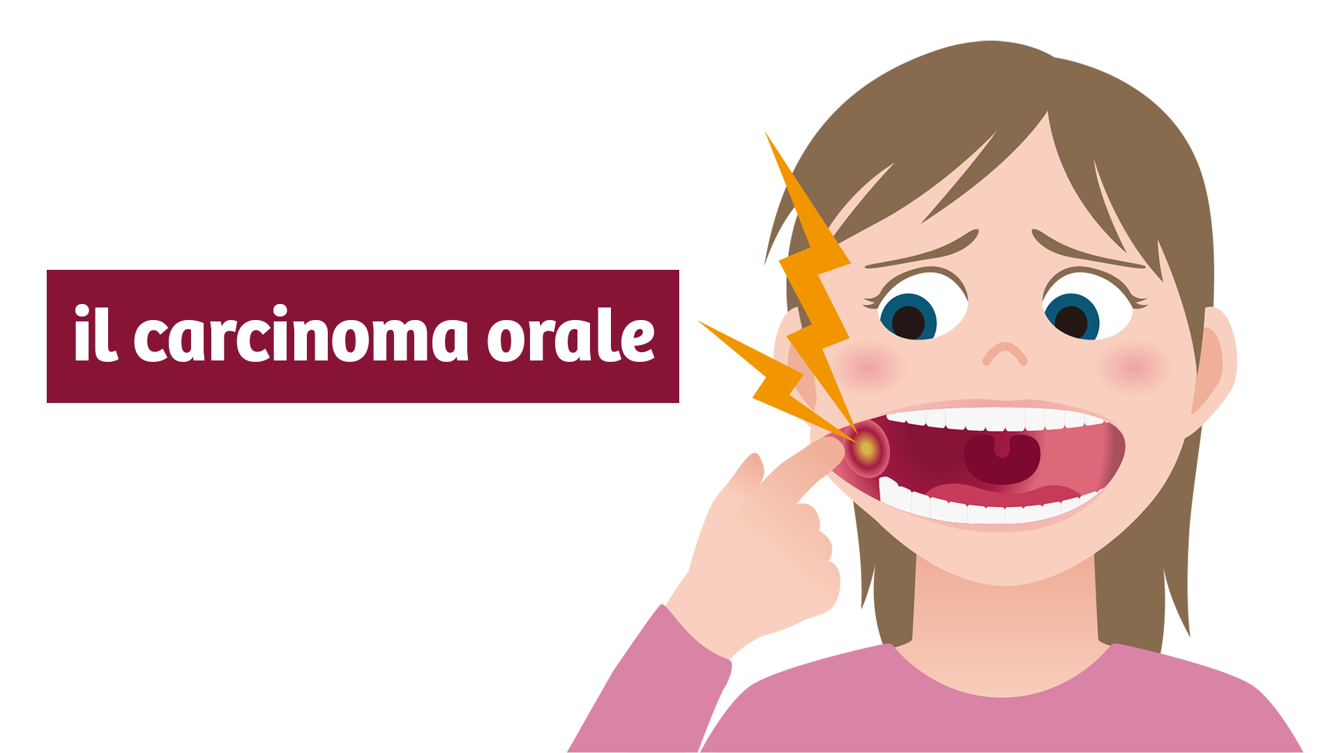 il carcinoma orale