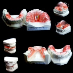 ortodonzia- mobile-avellino-studio-dentistico-dargenio