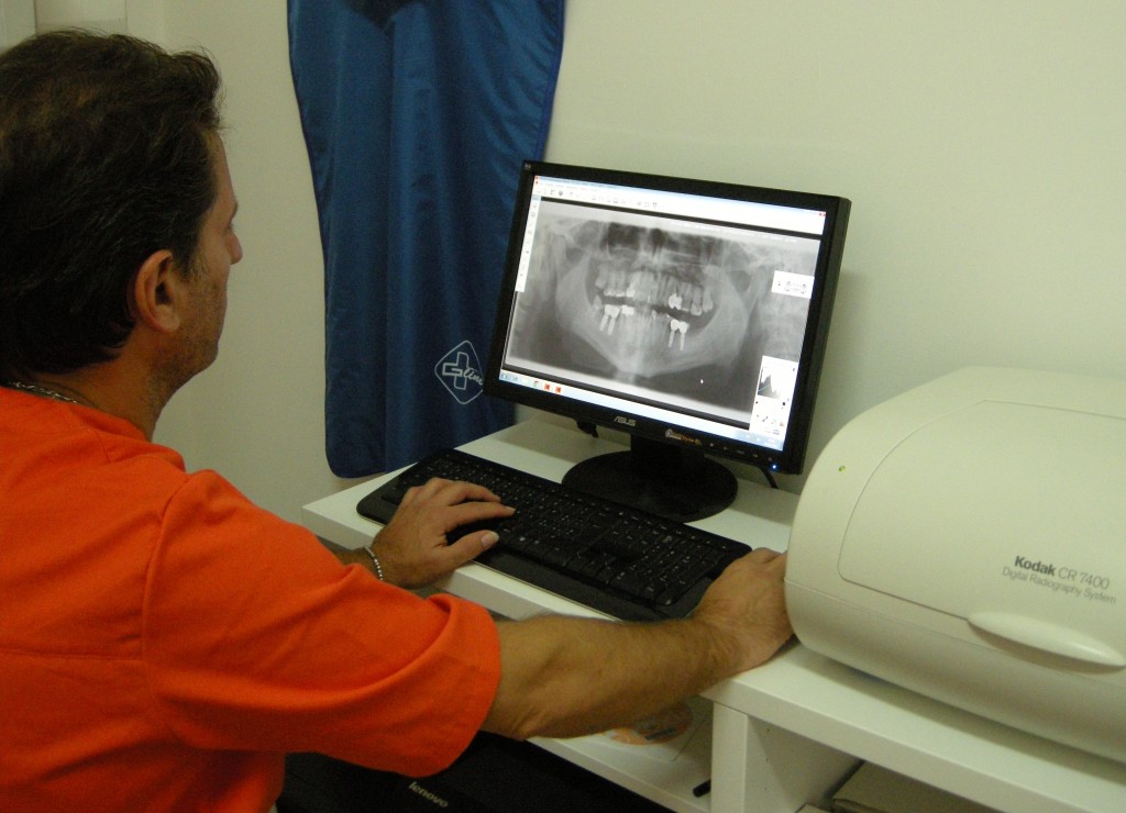 radiografia-digitale-avellino-studio-dentistico-dargenio