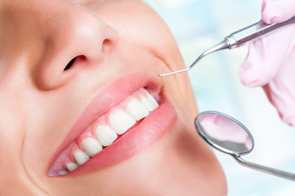 Cosa è lo sbiancamento dentale?